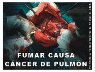 Peru 2008 Health Effects Lung - Lung Cancer, surgery, graphic